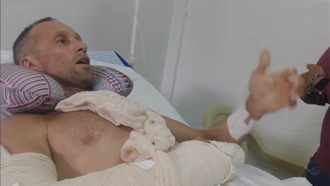   VALTER está internado no Hospital Regional Tarcísio Maia, em Mossoró, se recuperando da explosão de fogos de artifício na passagem de ano em Grossos