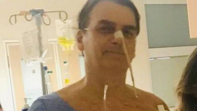  A internação do presidente Jair Bolsonaro no hospital Albert Einstein, em São Paulo, entre janeiro e fevereiro deste ano, custará R$ 400 mil aos cofres públicos