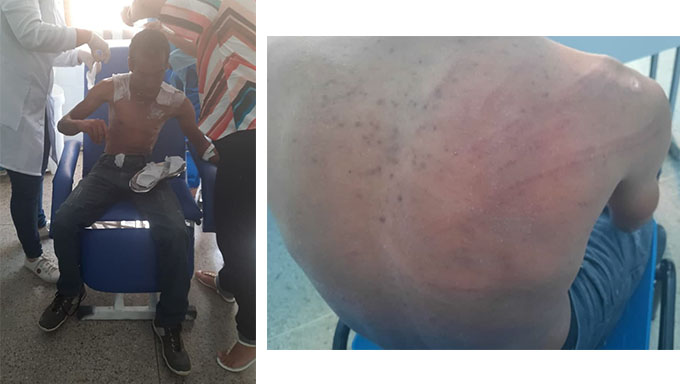   Irmã da vítima, Ceição, contou ao MH que o comerciante Alderan Freitas foi extremamente cruel com o irmão dela. Que num certo momento, os vizinhos dela acreditavam que Alderan estava matando Luciano Simplicio, que ficou com fortes hematomas no rosto, marcas de arrasto e cordas nas costas, além de várias outras escoriações. "Esperamos Justiça", diz Ceição.