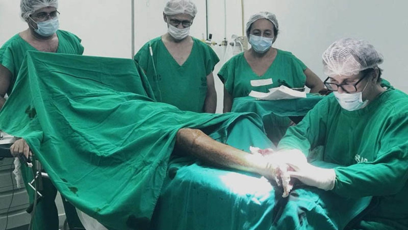 Imagem 1 - Saúde do RN ultrapassa mais de 1500 cirurgias vasculares realizadas em 10 meses. O programa de cirurgias vasculares da Secretaria de Estado da Saúde Pública (Sesap) do RN foi iniciado em novembro de 2022, o que representa uma média de 150 cirurgias realizadas por mês, atendendo pacientes de todas as regiões do Rio Grande do Norte. A iniciativa representa uma mudança na realidade da fila de cirurgias vasculares, que reduziu em 80% desde o início do programa, envolvendo sete hospitais da rede estadual e outros três contratados para prestação do serviço. Imagem 1 - Saúde do RN ultrapassa mais de 1500 cirurgias vasculares realizadas em 10 meses. O programa de cirurgias vasculares da Secretaria de Estado da Saúde Pública (Sesap) do RN foi iniciado em novembro de 2022, o que representa uma média de 150 cirurgias realizadas por mês, atendendo pacientes de todas as regiões do Rio Grande do Norte. A iniciativa representa uma mudança na realidade da fila de cirurgias vasculares, que reduziu em 80% desde o início do programa, envolvendo sete hospitais da rede estadual e outros três contratados para prestação do serviço.
