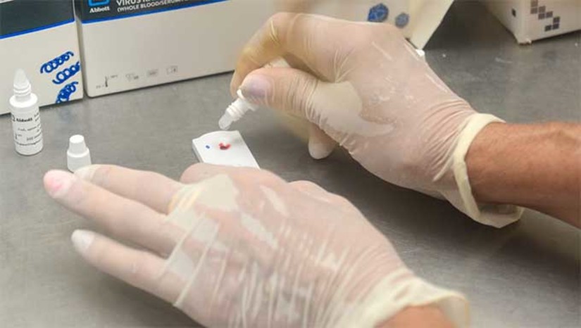 Imagem 1 -  A campanha tem abrangência nacional e marca a luta contra o vírus HIV, a Aids e outras ISTs. A mobilização objetiva chamar a atenção da sociedade para a prevenção, assistência, proteção e direitos das pessoas infectadas com o HIV. O lançamento será realizado no auditório do Centro Administrativo da Cidadania Pref. Alcides Belo, no bairro Aeroporto, a partir das 8h.