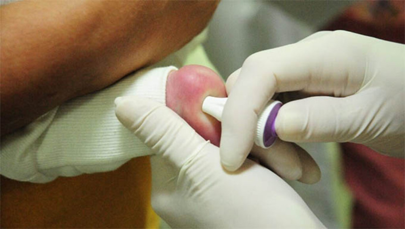 Imagem 1 -  Lei determina realização de Teste Genético para detectação de AME em recém-nascido no RN. O teste para detecção da doença designada Atrofia Muscular Espinhal (AME) deve ser realizado na triagem neonatal na rede pública e privada de saúde do Estado e com cobertura do SUS. A nova lei foi sancionada pela governadora Fátima Bezerra e publicada na edição desta terça-feira (3) do Diário Oficial do Estado (DOE).