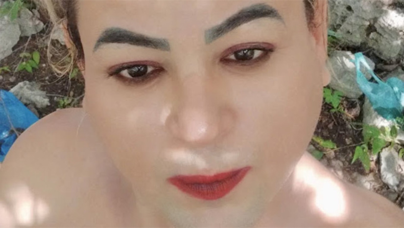   Segundo os peritos, Alcélio foi assassinado com um disparo de arma de fogo no rosto, desfazendo rumores iniciais de que ele teria sido morto a pedradas. Era muito conhecido na região, pelo forma gentil como atendias as pessoas enfermas no Hospital Regional Helio Morais Marinho, em Apodi.