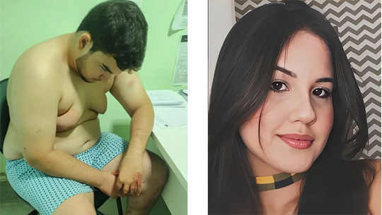   Um crime bárbaro aconteceu durante a madrugada desta segunda-feira, 26, na cidade de Umarizal, após a vítima participar da festa da vitória de Lula. Clara Maia sofreu três facadas — uma delas na garganta — e se encontra na UTI do Hospital de Pau dos Ferros. Eduardo Ronald foi preso em flagrante e, nesta terça-feira, 27, a Justiça decretou sua prisão preventiva para garantir a ordem pública, a conveniência da instrução processual e devido à conduta reprovável do réu, além do fato de o local do crime ter sido manipulado pela família.